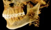 facial x-ray for dentist